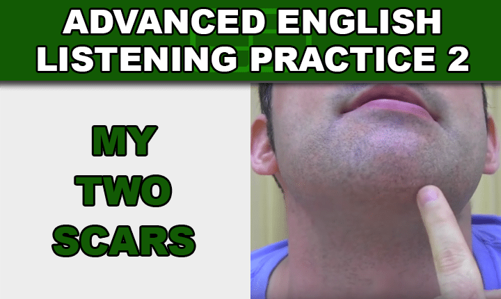 Advanced English Listening Practice 2 My Two Scars - Improve your listening skills and understand understand spoken English with an advanced English listening practice video lesson about personal injuries